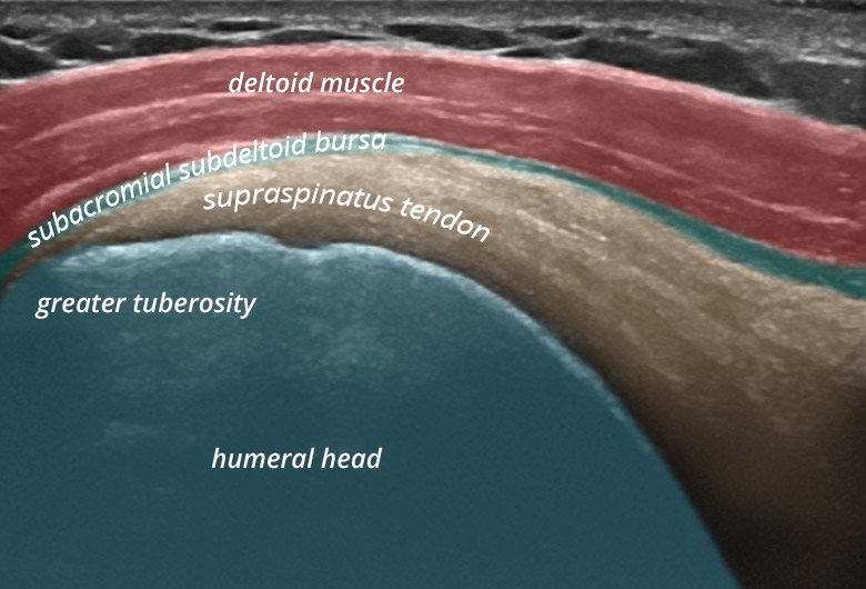 Shoulder anterior lateral supraspinatus longitudinal