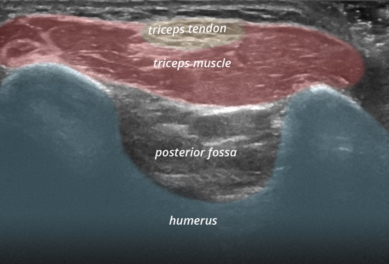 Elbow fossa olecrani triceps transverse