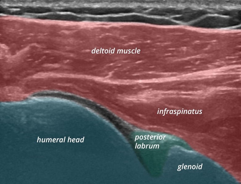 Shoulder posterior glenohumeral joint longitudinal